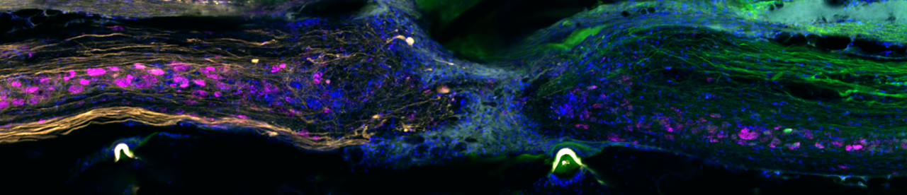 Spinal Cord Regeneration Lesion Site Microscopy